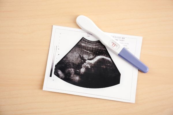 taux HCG et test de grossesse